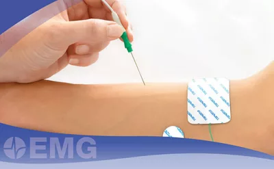 Ghi điện cơ