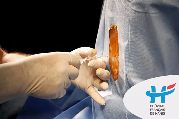 Những điều mẹ bầu sắp sinh cần biết về gây tê ngoài màng cứng