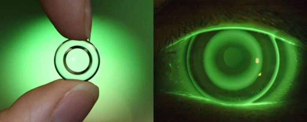 ortho K_lens