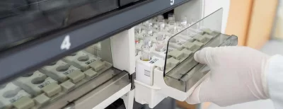 Screening for liver, gallbladder &amp; pancreas cancer