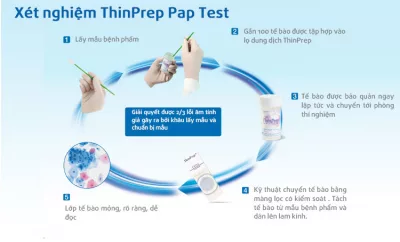ThinPrep Test &#8211; Tiến bộ mới trong phát hiện sớm ung thư cổ tử cung