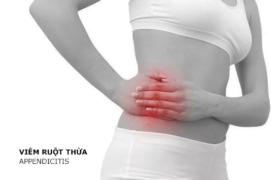 Appendicitis