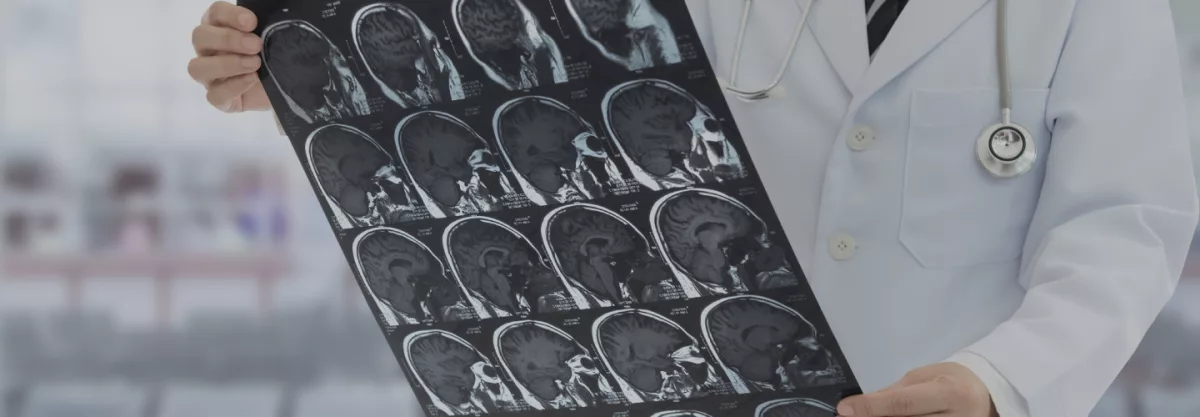 Neuro
