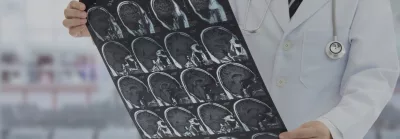 Neuro