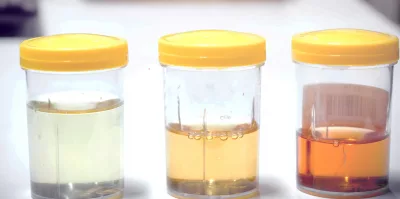 Nước ối đục có đẻ thường được không? Tìm hiểu ngay