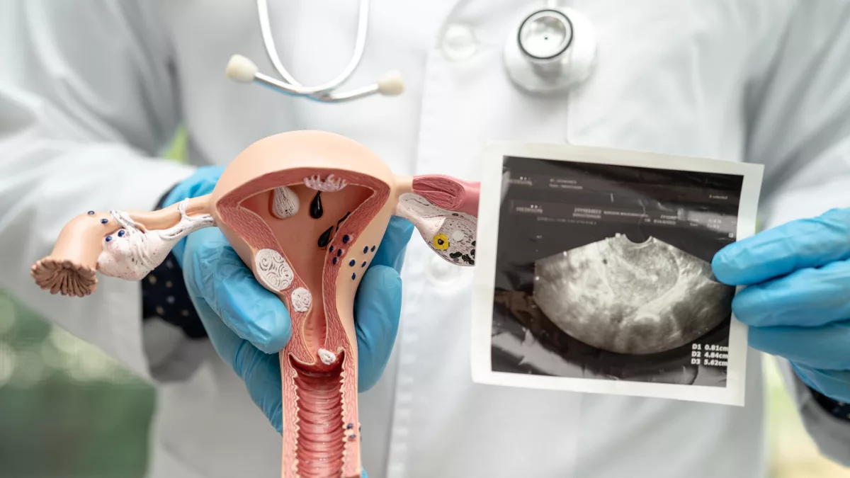 Sa tử cung sau sinh thường, triệu chứng, nguyên nhân, cách chữa