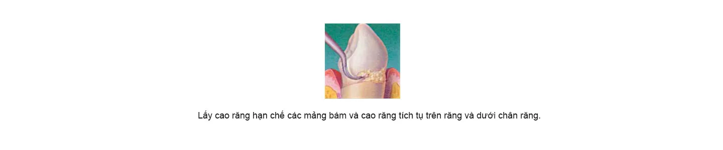 Lay cao rang