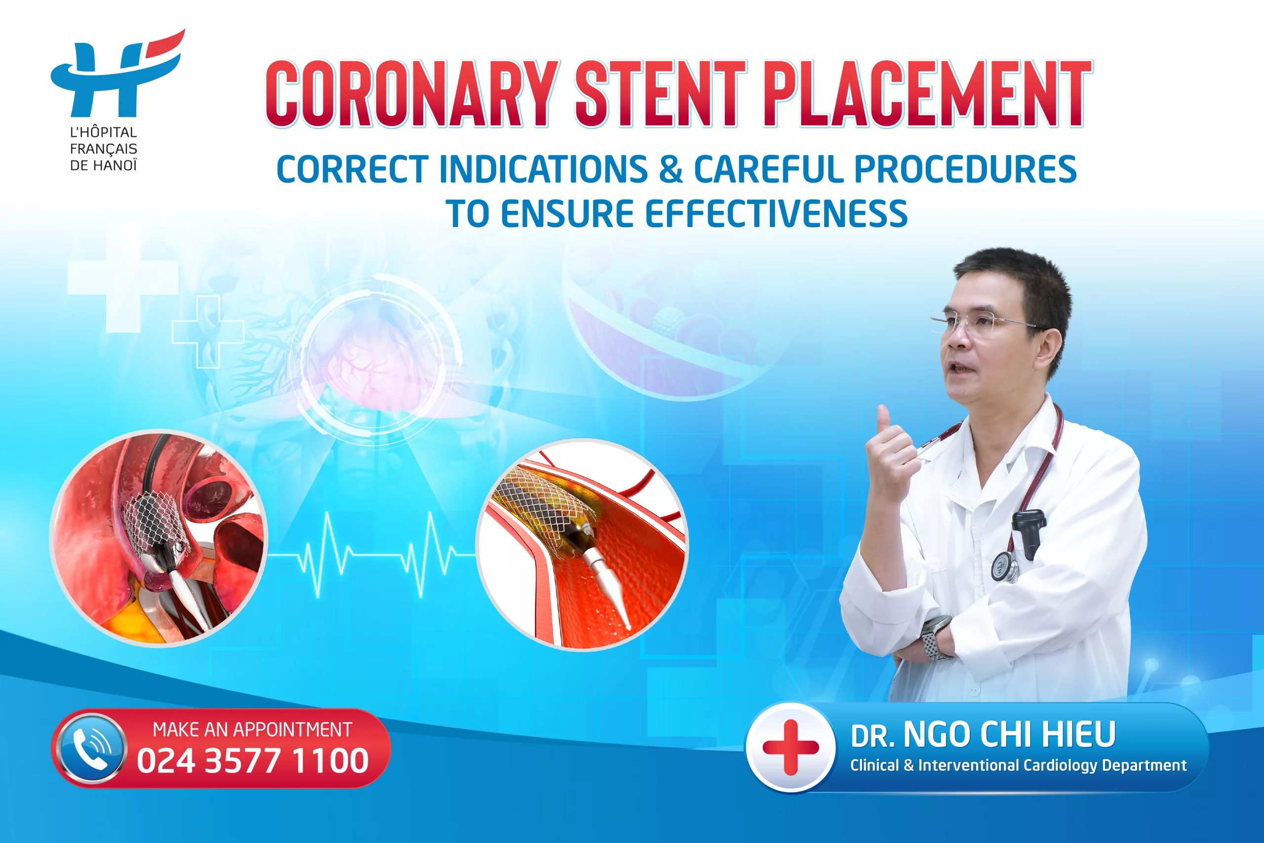 CORONARY STENT PLACEMENT – CORRECT INDICATIONS AND CAREFUL PROCEDURES TO ENSURE EFFECTIVENESS