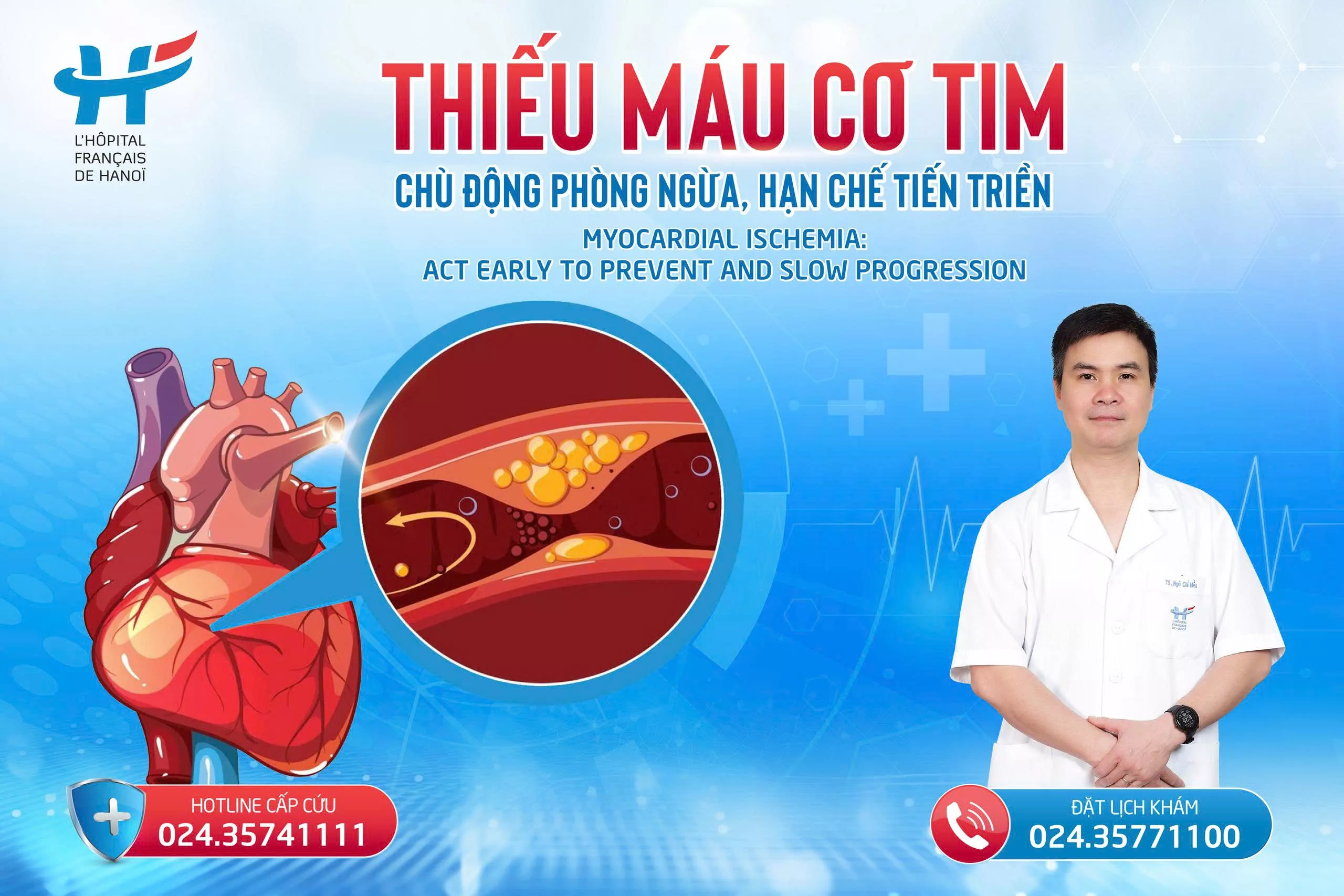 THIẾU MÁU CƠ TIM: CHỦ ĐỘNG PHÒNG NGỪA, HẠN CHẾ TIẾN TRIỂN