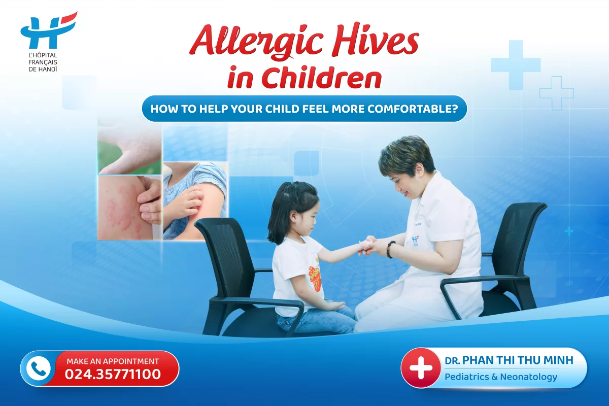 Allergic Hives in Children: How to Help Your Child Feel More Comfortable