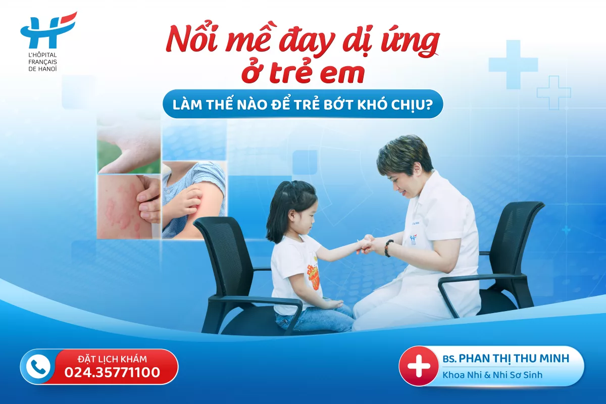Nổi mề đay dị ứng ở trẻ em: Làm thế nào để trẻ bớt khó chịu?