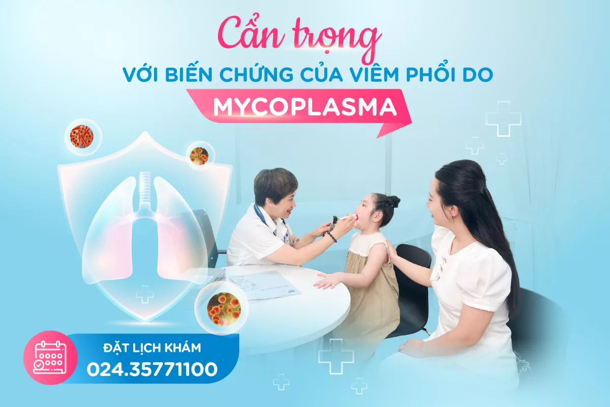 CẨN TRỌNG VỚI BIẾN CHỨNG CỦA VIÊM PHỔI DO MYCOPLASMA