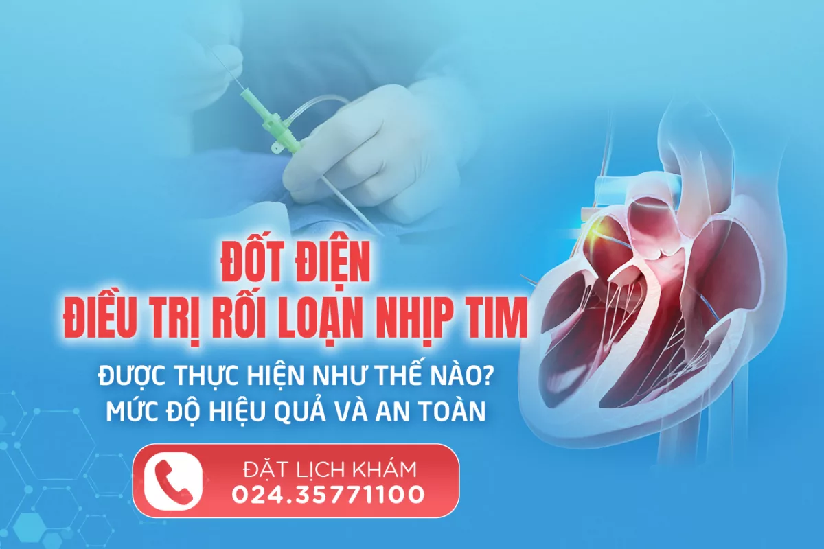 Triệt đốt qua đường ống thông sử dụng năng lượng cao tần RF được thực hiện như thế nào? Có an toàn không?