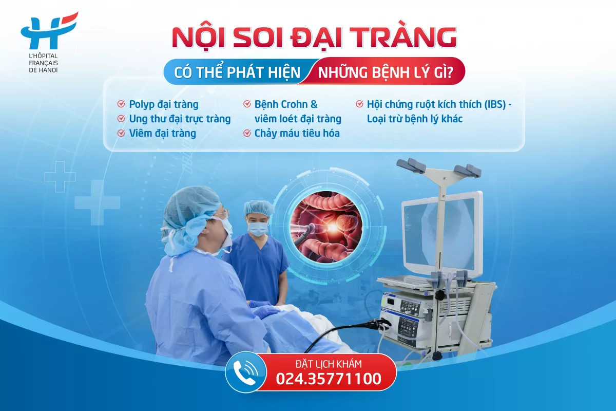 Nội soi đại tràng có thể phát hiện những bệnh lý gì?