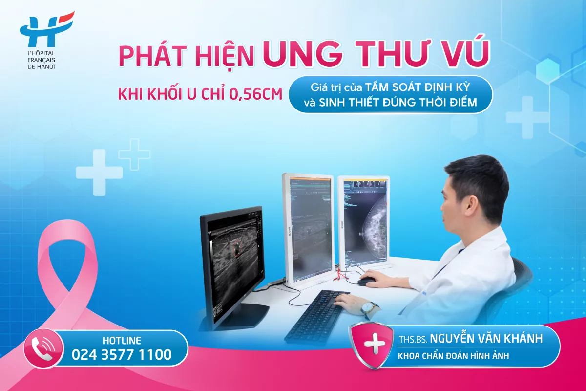 PHÁT HIỆN UNG THƯ VÚ KHI KHỐI U CHỈ 0,56CM: GIÁ TRỊ CỦA TẦM SOÁT ĐỊNH KỲ VÀ SINH THIẾT ĐÚNG THỜI ĐIỂM