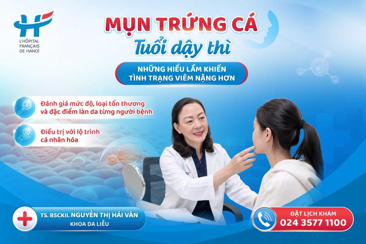 MỤN TRỨNG CÁ TUỔI DẬY THÌ: NHỮNG HIỂU LẦM KHIẾN TÌNH TRẠNG VIÊM NẶNG HƠN