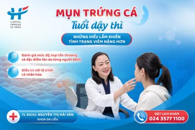 MỤN TRỨNG CÁ TUỔI DẬY THÌ: NHỮNG HIỂU LẦM KHIẾN TÌNH TRẠNG VIÊM NẶNG HƠN
