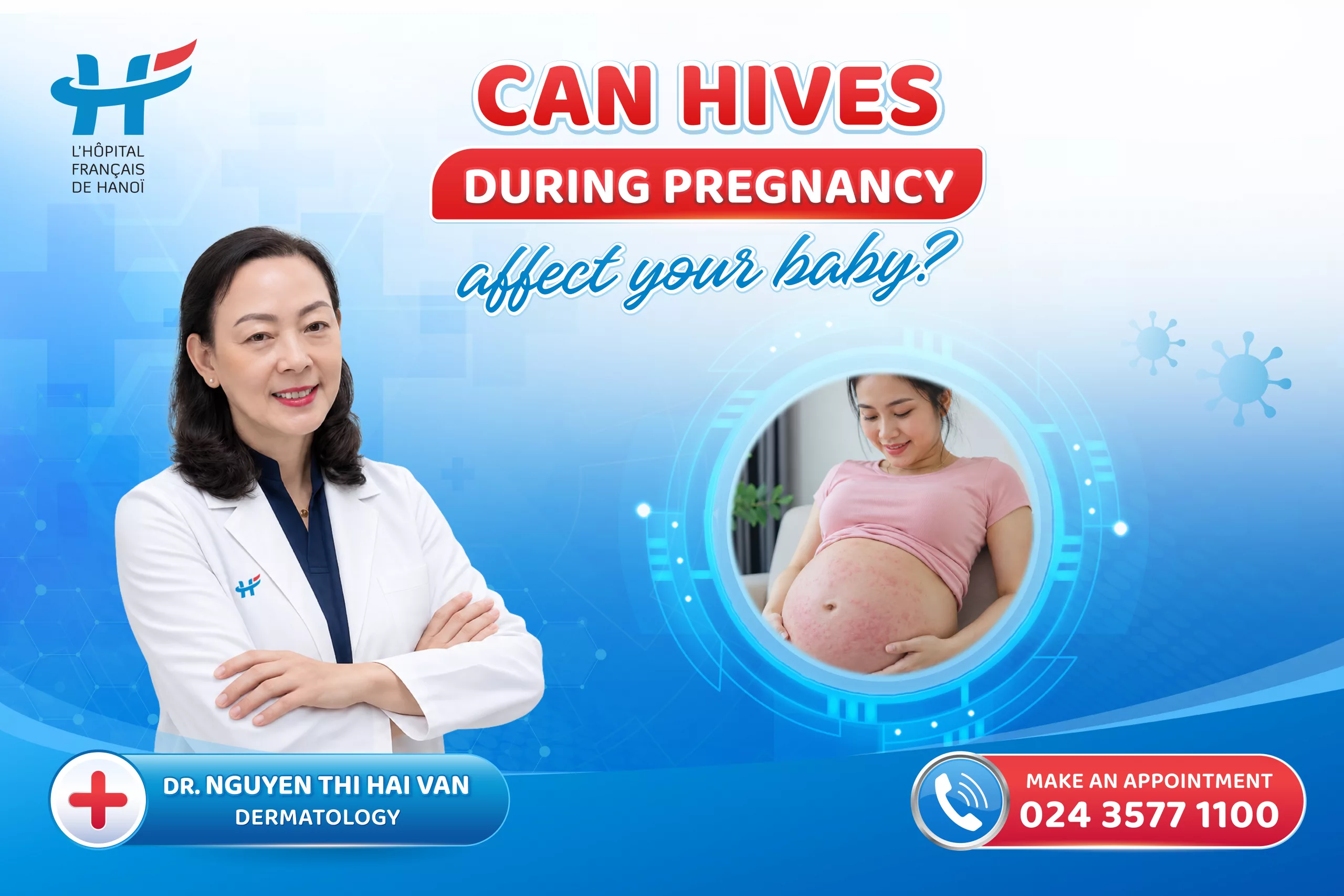 Can hives during pregnancy affect your baby?