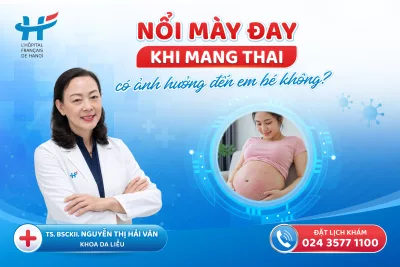 Nổi mày đay khi mang thai có ảnh hưởng đến em bé không?