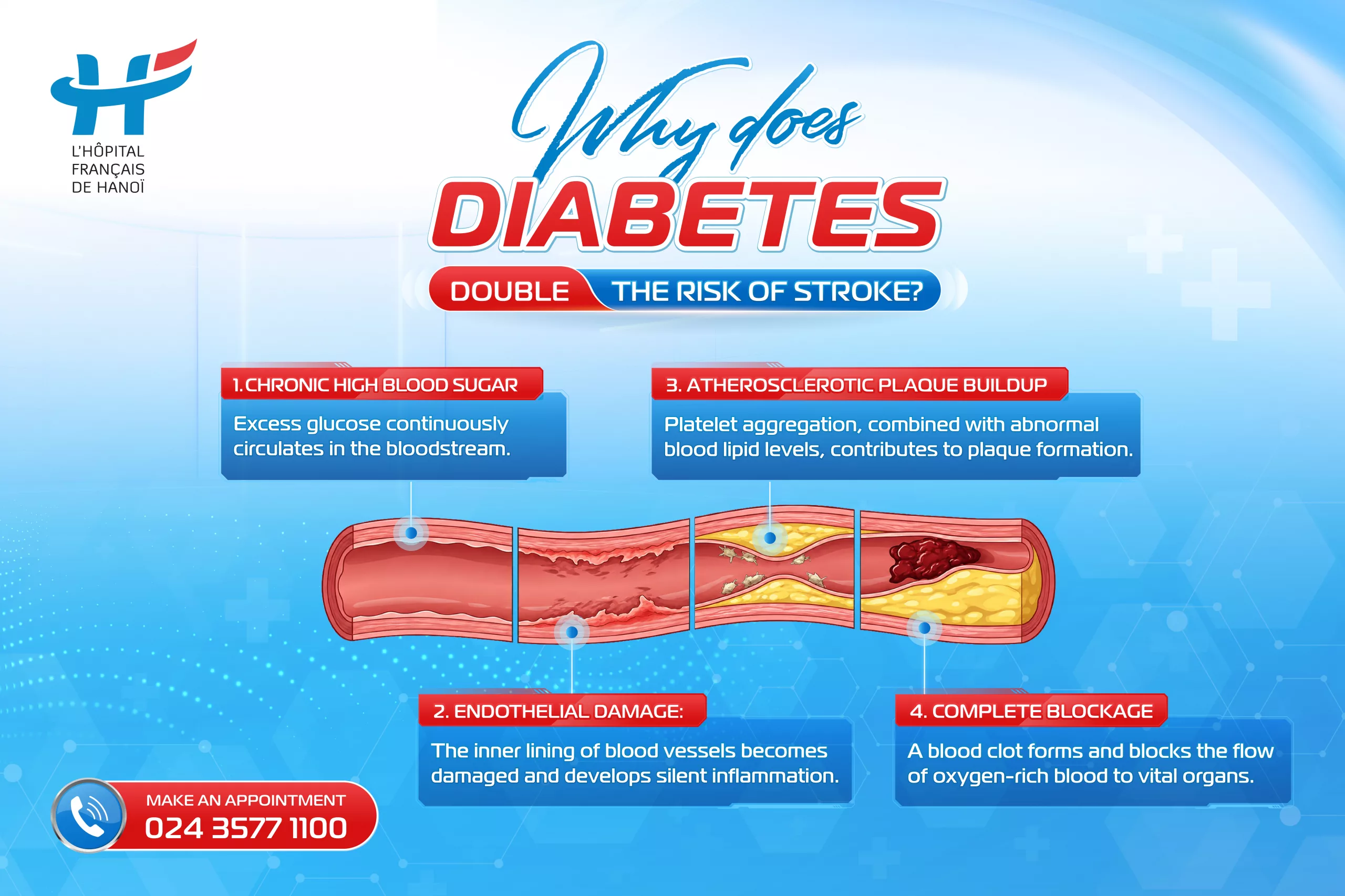 WHY DOES DIABETES DOUBLE THE RISK OF STROKE?