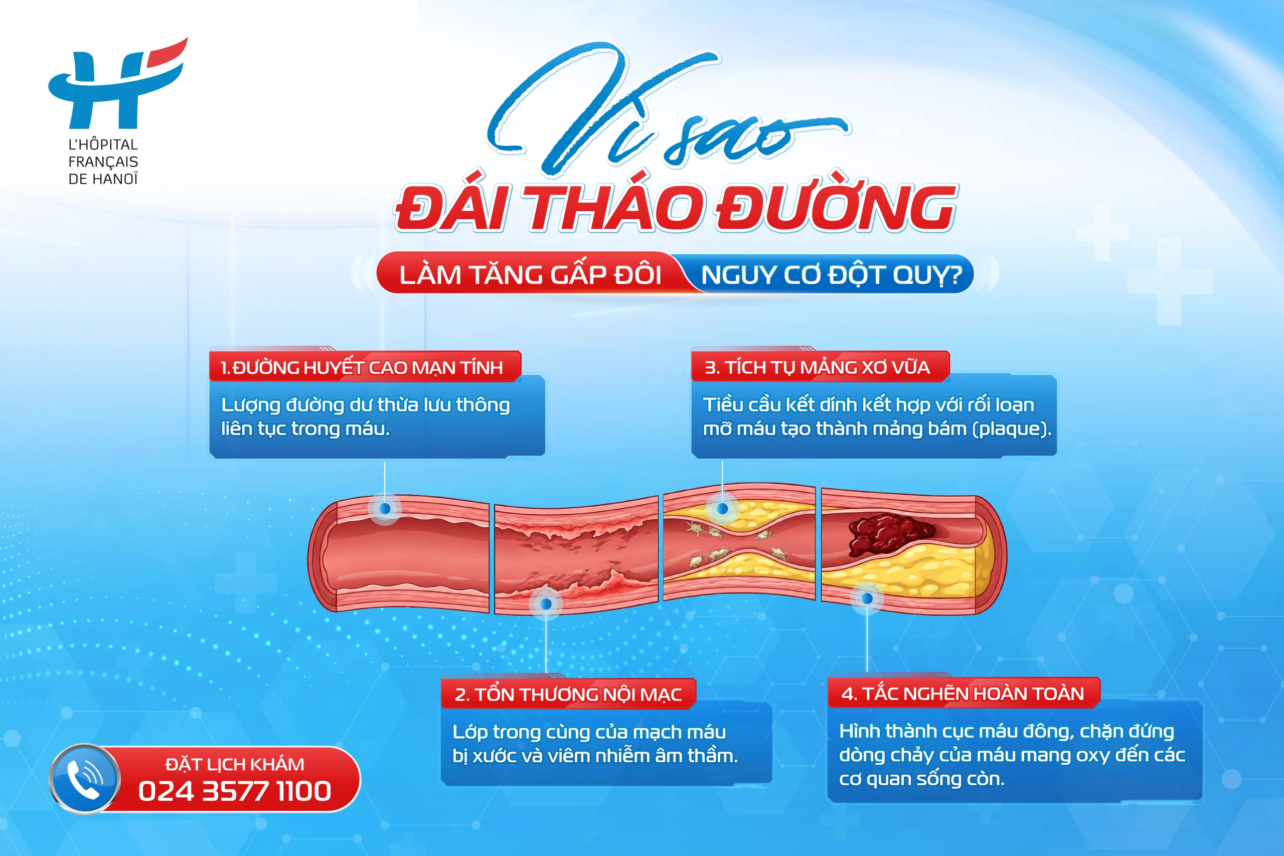 VÌ SAO ĐÁI THÁO ĐƯỜNG LÀM TĂNG GẤP ĐÔI NGUY CƠ ĐỘT QUỴ?